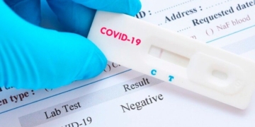 Togo : Les Etats Unis alertent leurs ressortissants sur la falsification des tests Covid
