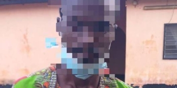 Lomé : un voleur déguisé en médecin dérobe la voiture de son ‘’patient’’