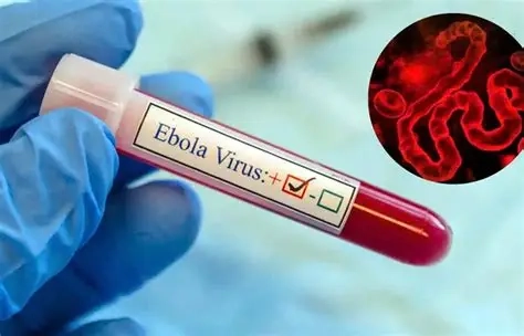 Ebola : la souche Bundibugyo, un défi pour la riposte sanitaire en Afrique